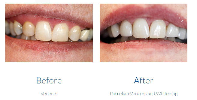 case study photo
