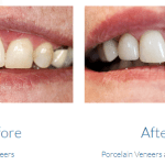 case study photo