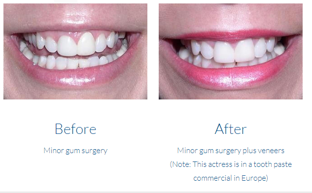case study photo