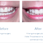 case study photo