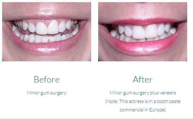 case study photo