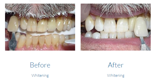 case study photo