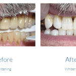 case study photo