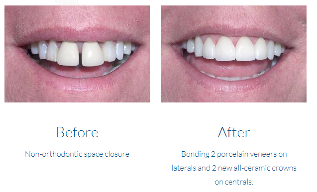 case study photo