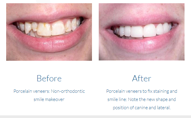 case study photo