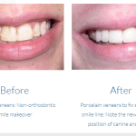 case study photo