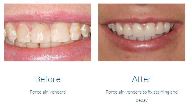 case study photo