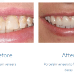 case study photo