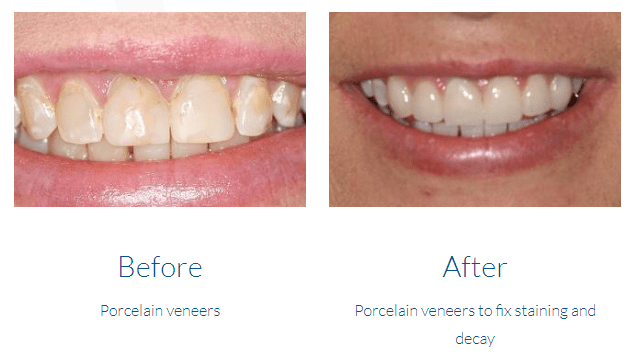 case study photo