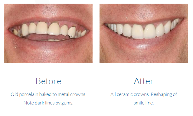 case study photo