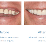 case study photo