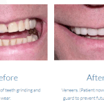 case study photo