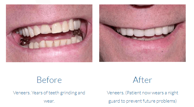 case study photo
