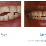 case study photo