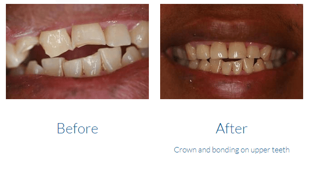 case study photo