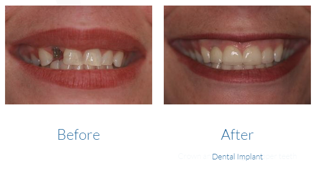 case study photo