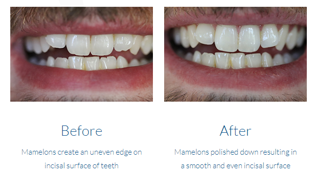 case study photo