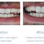 case study photo