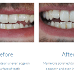 case study photo