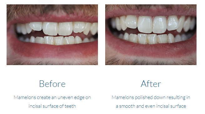 case study photo