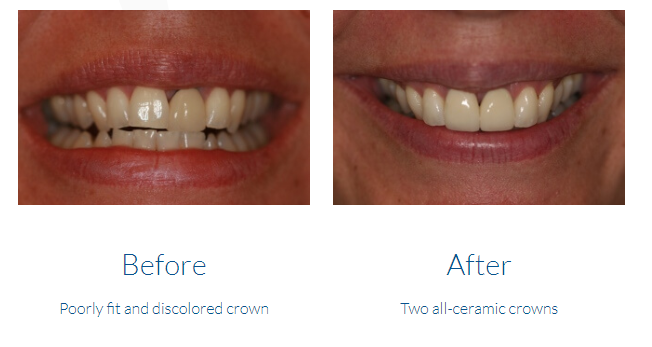 case study photo