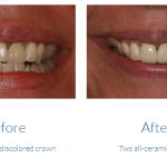 case study photo