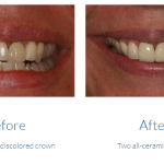 case study photo