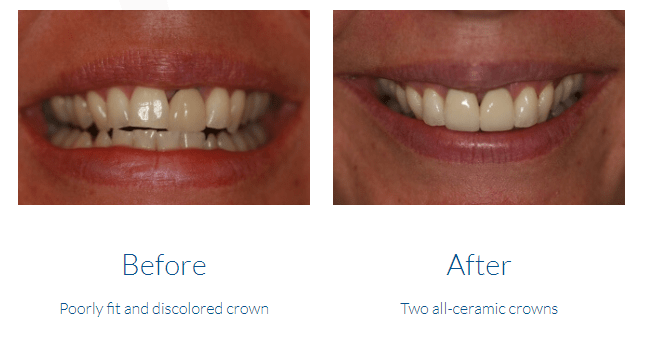 case study photo