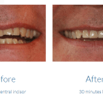 case study photo