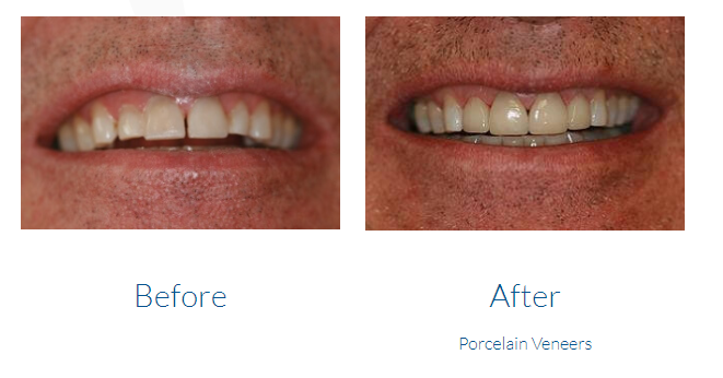 case study photo