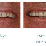 case study photo