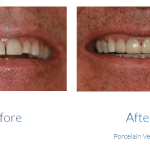 case study photo