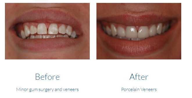case study photo