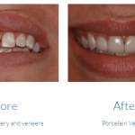 case study photo
