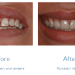 case study photo