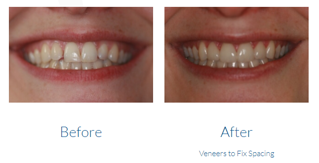 case study photo