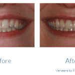 case study photo
