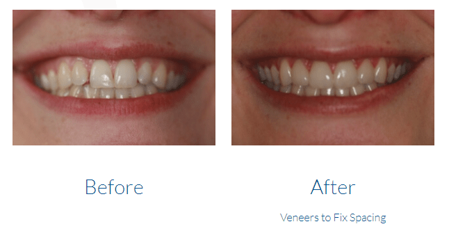 case study photo