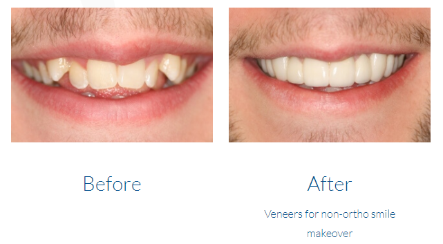 case study photo