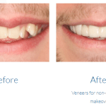 case study photo